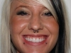 3lipandseptum