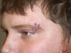 4eyebrowdouble