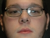 septumcbr2